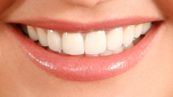 white perfect smile after