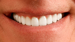 Small & yellow teeth after