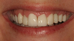 Yellow smile before