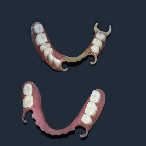 Two partial dentures