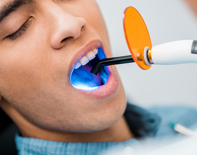 Dental patient having an ultraviolet light shone onto their tooth