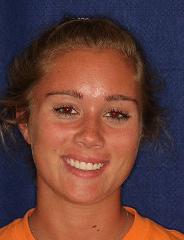 Teenage girl smiling with slightly yellowed teeth