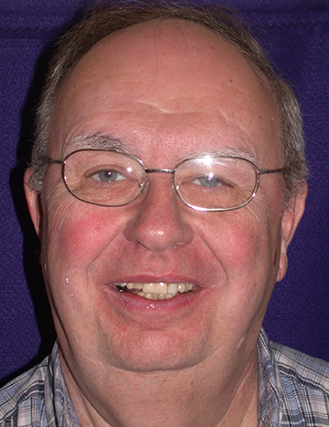 Smiling senior man with uneven and stained teeth