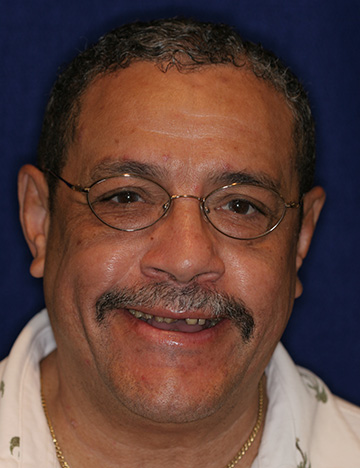 Older man smiling with short and discolored teeth
