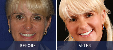 woman's before and after makeover