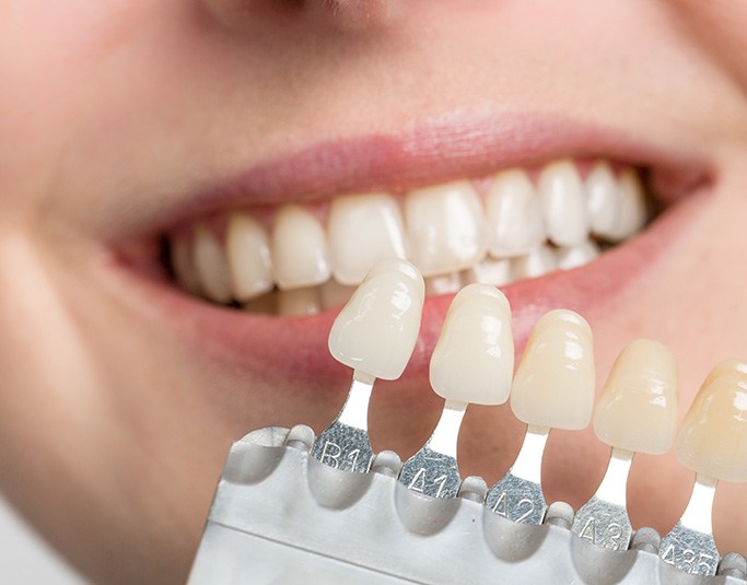 Veneers have many benefits including stain resistance