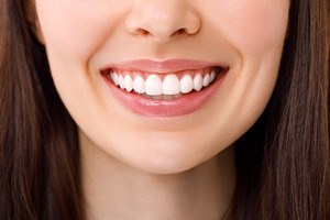 Close-up of a woman showing off her smile