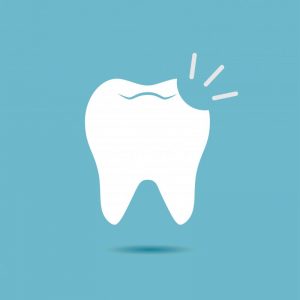 illustration of a chipped tooth in Windermere